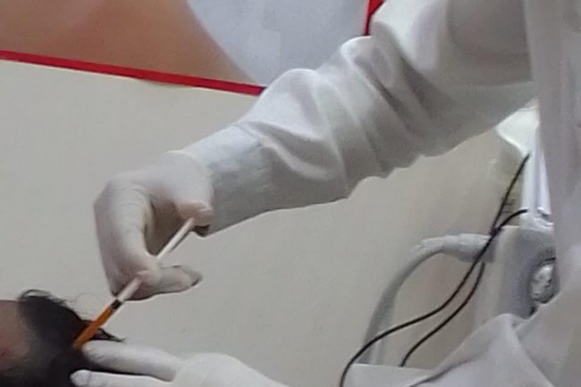 A PRP treatment is the way to go if you want to grow out new, healthy hair.